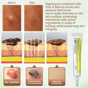 ✨✨𝐺𝑙𝑖𝑚𝑚𝑒𝑟𝑙𝑦® 𝑃𝑎𝑟𝑜𝑚𝑜𝑚𝑦𝑐𝑖𝑛 & 𝑉𝑖𝑡𝑎-𝑎 𝑅𝑒𝑡𝑖𝑛𝑜𝑙 𝑆ℎ𝑜𝑡 𝑆𝑘𝑖𝑛 𝑅𝑒𝑝𝑎𝑖𝑟 𝐶𝑟𝑒𝑎𝑚（𝐖𝐢𝐭𝐡 𝐋𝐢𝐪𝐮𝐢𝐝 𝐌𝐢𝐜𝐫𝐨𝐧𝐞𝐞𝐝𝐥𝐞𝐬, 𝐆𝐞𝐧𝐭𝐥𝐲 𝐆𝐞𝐭𝐬 𝐑𝐢𝐝 𝐎𝐟 𝐖𝐚𝐫𝐭𝐬, 𝐌𝐨𝐥𝐞𝐬, 𝐀𝐠𝐞 𝐒𝐩𝐨𝐭𝐬, 𝐀𝐧𝐝 𝐒𝐤𝐢𝐧 𝐓𝐚𝐠𝐬 ）