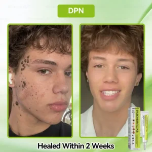 ✨✨𝐺𝑙𝑖𝑚𝑚𝑒𝑟𝑙𝑦® 𝑃𝑎𝑟𝑜𝑚𝑜𝑚𝑦𝑐𝑖𝑛 & 𝑉𝑖𝑡𝑎-𝑎 𝑅𝑒𝑡𝑖𝑛𝑜𝑙 𝑆ℎ𝑜𝑡 𝑆𝑘𝑖𝑛 𝑅𝑒𝑝𝑎𝑖𝑟 𝐶𝑟𝑒𝑎𝑚（𝐖𝐢𝐭𝐡 𝐋𝐢𝐪𝐮𝐢𝐝 𝐌𝐢𝐜𝐫𝐨𝐧𝐞𝐞𝐝𝐥𝐞𝐬, 𝐆𝐞𝐧𝐭𝐥𝐲 𝐆𝐞𝐭𝐬 𝐑𝐢𝐝 𝐎𝐟 𝐖𝐚𝐫𝐭𝐬, 𝐌𝐨𝐥𝐞𝐬, 𝐀𝐠𝐞 𝐒𝐩𝐨𝐭𝐬, 𝐀𝐧𝐝 𝐒𝐤𝐢𝐧 𝐓𝐚𝐠𝐬 ）