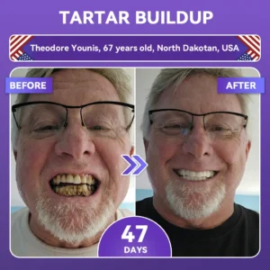 ✨👍𝐺𝑙𝑖𝑚𝑚𝑒𝑟𝑙𝑦® 𝐴𝑑𝑣𝑎𝑛𝑐𝑒𝑑 𝑃𝑢𝑟𝑝𝑙𝑒 𝑊ℎ𝑖𝑡𝑒𝑛𝑖𝑛𝑔 𝑆𝑡𝑟𝑖𝑝𝑠