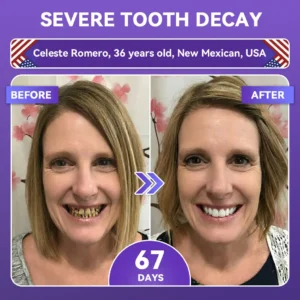 ✨👍𝐺𝑙𝑖𝑚𝑚𝑒𝑟𝑙𝑦® 𝐴𝑑𝑣𝑎𝑛𝑐𝑒𝑑 𝑃𝑢𝑟𝑝𝑙𝑒 𝑊ℎ𝑖𝑡𝑒𝑛𝑖𝑛𝑔 𝑆𝑡𝑟𝑖𝑝𝑠