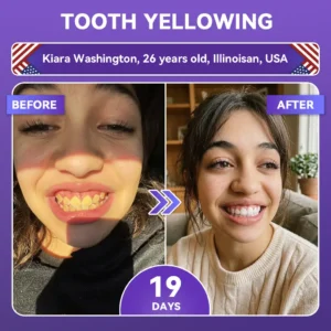 ✨👍𝐺𝑙𝑖𝑚𝑚𝑒𝑟𝑙𝑦® 𝐴𝑑𝑣𝑎𝑛𝑐𝑒𝑑 𝑃𝑢𝑟𝑝𝑙𝑒 𝑊ℎ𝑖𝑡𝑒𝑛𝑖𝑛𝑔 𝑆𝑡𝑟𝑖𝑝𝑠