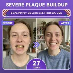 ✨👍𝐺𝑙𝑖𝑚𝑚𝑒𝑟𝑙𝑦® 𝐴𝑑𝑣𝑎𝑛𝑐𝑒𝑑 𝑃𝑢𝑟𝑝𝑙𝑒 𝑊ℎ𝑖𝑡𝑒𝑛𝑖𝑛𝑔 𝑆𝑡𝑟𝑖𝑝𝑠