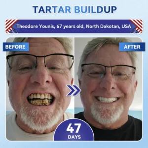 Glimmerly® 🦷 Tideglusib Fast‑Dissolving Tooth & Gum Repair Oral Strips
 – shiftslim