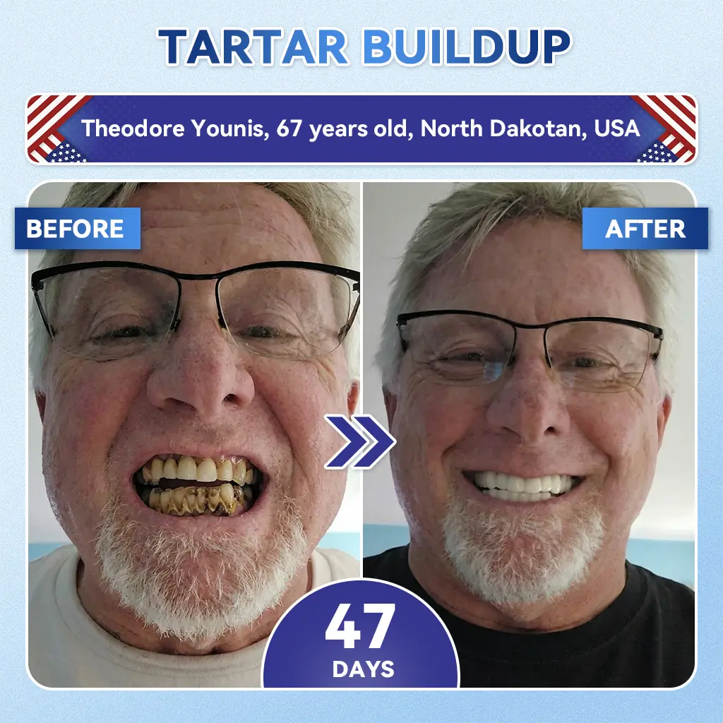 Glimmerly® Tooth & Gum Repair
Clinical-Grade Microneedle Patches