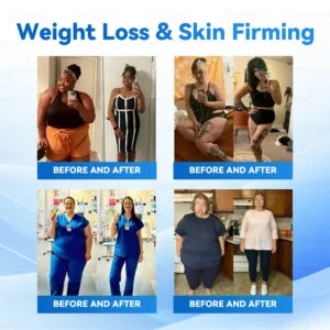 OFFICIAL
    BRAND
  
  𝑶𝒇𝒇𝒊𝒄𝒊𝒂𝒍 𝑺𝒕𝒐𝒓𝒆  | 💚 𝑮𝒍𝒊𝒎𝒎𝒆𝒓𝒍𝒚® 𝑴𝒐𝒓𝒊𝒏𝒈𝒂 & 𝑩𝒆𝒓𝒃𝒆𝒓𝒊𝒏𝒆 10-𝑰𝑵-1 𝑨𝒅𝒗𝒂𝒏𝒄𝒆𝒅 𝑵𝒂𝒏𝒐 𝑴𝒊𝒄𝒓𝒐𝒏𝒆𝒆𝒅𝒍𝒆 𝑷𝒂𝒕𝒄𝒉 (𝐎𝐧𝐜𝐞 𝐃𝐚𝐢𝐥𝐲, 𝐯𝐢𝐬𝐢𝐛𝐥𝐞 𝐜𝐡𝐚𝐧𝐠𝐞𝐬 𝐢𝐧 𝟕 𝐝𝐚𝐲𝐬）✅ 𝐎𝐛𝐞𝐬𝐢𝐭𝐲, 𝐃𝐢𝐚𝐛𝐞𝐭𝐞𝐬, 𝐒𝐥𝐞𝐞𝐩 𝐀𝐩𝐧𝐞𝐚, 𝐀𝐧𝐝 𝐉𝐨𝐢𝐧𝐭 𝐈𝐬𝐬𝐮𝐞𝐬