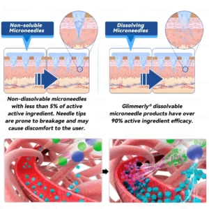 OFFICIAL
    BRAND
  
  𝑶𝒇𝒇𝒊𝒄𝒊𝒂𝒍 𝑺𝒕𝒐𝒓𝒆  | 💚 𝑮𝒍𝒊𝒎𝒎𝒆𝒓𝒍𝒚® 𝑴𝒐𝒓𝒊𝒏𝒈𝒂 & 𝑩𝒆𝒓𝒃𝒆𝒓𝒊𝒏𝒆 10-𝑰𝑵-1 𝑨𝒅𝒗𝒂𝒏𝒄𝒆𝒅 𝑵𝒂𝒏𝒐 𝑴𝒊𝒄𝒓𝒐𝒏𝒆𝒆𝒅𝒍𝒆 𝑷𝒂𝒕𝒄𝒉 (𝐎𝐧𝐜𝐞 𝐃𝐚𝐢𝐥𝐲, 𝐯𝐢𝐬𝐢𝐛𝐥𝐞 𝐜𝐡𝐚𝐧𝐠𝐞𝐬 𝐢𝐧 𝟕 𝐝𝐚𝐲𝐬）✅ 𝐎𝐛𝐞𝐬𝐢𝐭𝐲, 𝐃𝐢𝐚𝐛𝐞𝐭𝐞𝐬, 𝐒𝐥𝐞𝐞𝐩 𝐀𝐩𝐧𝐞𝐚, 𝐀𝐧𝐝 𝐉𝐨𝐢𝐧𝐭 𝐈𝐬𝐬𝐮𝐞𝐬