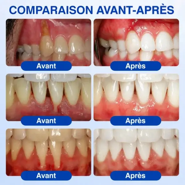 🪻💖𝑮𝒍𝒊𝒎𝒎𝒆𝒓𝒍𝒚®🦷 𝑮𝒖𝒎𝑹𝒆𝒗𝒊𝒗𝒆 𝑮𝒆𝒍 𝒅𝒆 𝑹é𝒑𝒂𝒓𝒂𝒕𝒊𝒐𝒏 𝑷𝒂𝒓𝒐𝒅𝒐𝒏𝒕𝒂𝒍𝒆