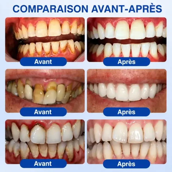 🪻💖𝑮𝒍𝒊𝒎𝒎𝒆𝒓𝒍𝒚®🦷 𝑮𝒖𝒎𝑹𝒆𝒗𝒊𝒗𝒆 𝑮𝒆𝒍 𝒅𝒆 𝑹é𝒑𝒂𝒓𝒂𝒕𝒊𝒐𝒏 𝑷𝒂𝒓𝒐𝒅𝒐𝒏𝒕𝒂𝒍𝒆