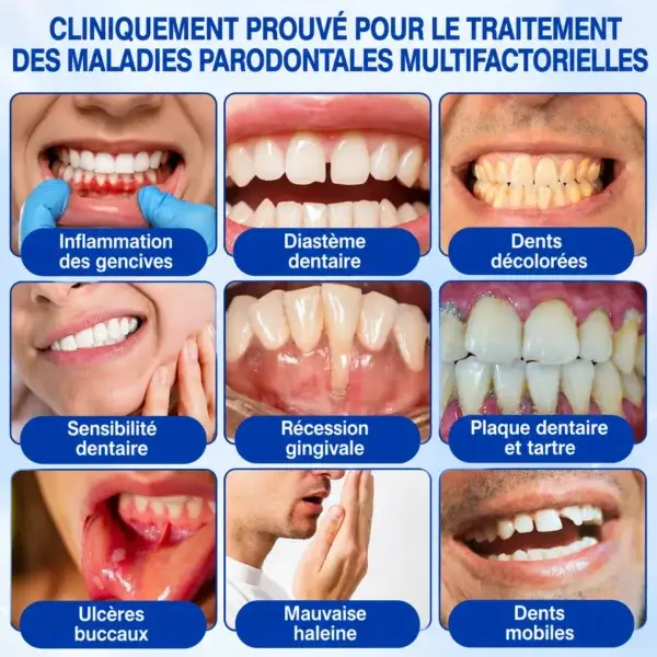 🪻💖𝑮𝒍𝒊𝒎𝒎𝒆𝒓𝒍𝒚®🦷 𝑮𝒖𝒎𝑹𝒆𝒗𝒊𝒗𝒆 𝑮𝒆𝒍 𝒅𝒆 𝑹é𝒑𝒂𝒓𝒂𝒕𝒊𝒐𝒏 𝑷𝒂𝒓𝒐𝒅𝒐𝒏𝒕𝒂𝒍𝒆