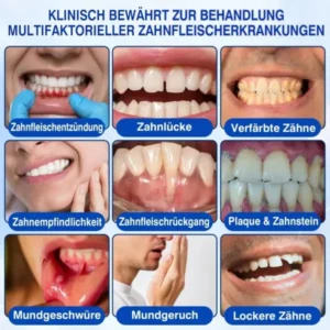 Glimmerly® GumRevive Parodontales Reparaturgel