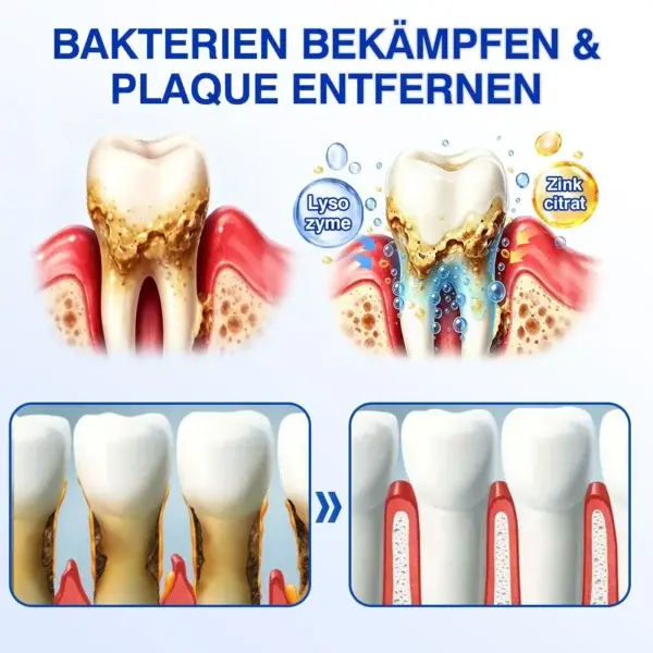 Glimmerly® GumRevive Parodontales Reparaturgel