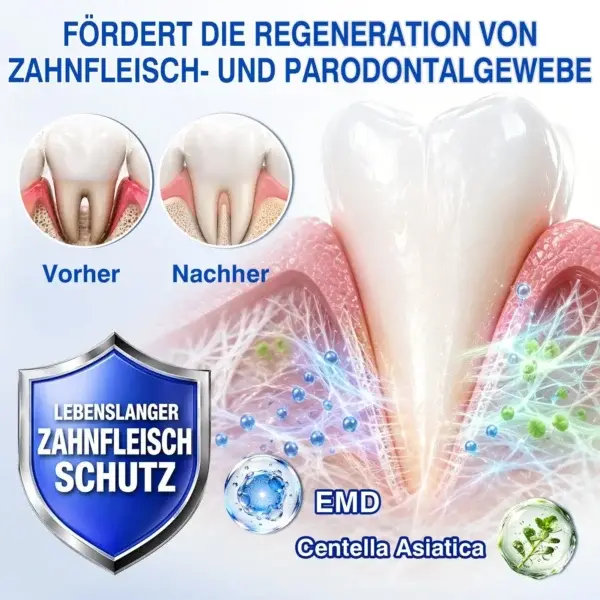 Glimmerly® GumRevive Parodontales Reparaturgel