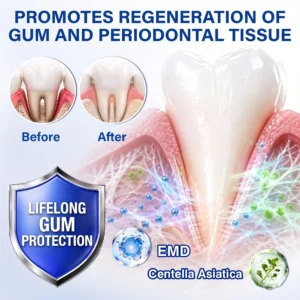 Glimmerly®🎋GumRevive periodontal repair gel🌵
 – shiftslim
