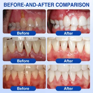Glimmerly®🎋GumRevive periodontal repair gel🌵
 – shiftslim