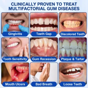 Glimmerly®🎋GumRevive periodontal repair gel🌵
 – shiftslim
