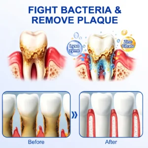 Glimmerly®🎋GumRevive periodontal repair gel🌵
 – shiftslim